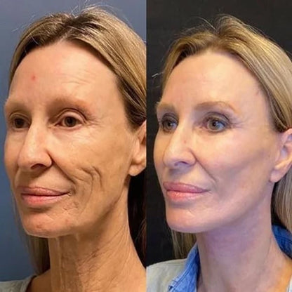 Botox Serum - NECESITYE